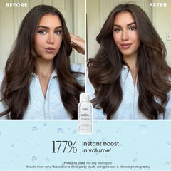 DRY SHAMPOO - 3 PACK