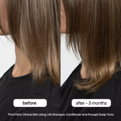 MINI ANTI-THINNING SHAMPOO