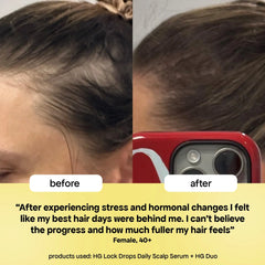 LOCK-IN THICKER HAIR: 6-MONTH SUPPLY