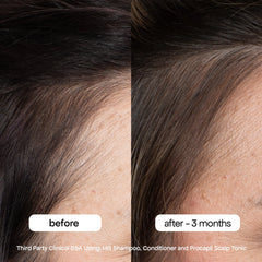 MINI ANTI-THINNING CONDITIONER