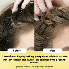 LOCK-IN THICKER HAIR: 3-MONTH SUPPLY