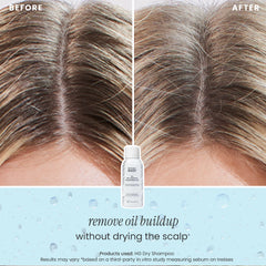 DRY SHAMPOO - 3 PACK